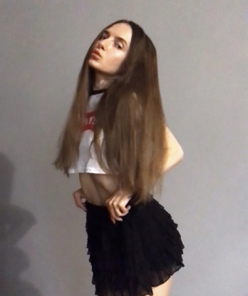 Альбина